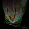 LIFE, GLITCH, DIE