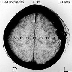 neurora