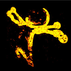 The FreeBorne Association