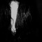 TRANCA-RUA (Sickness)