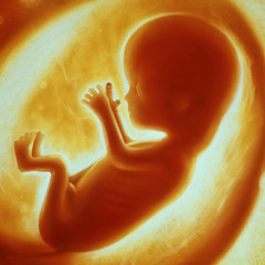 Level Fetus