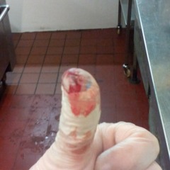 ouch yah bugger