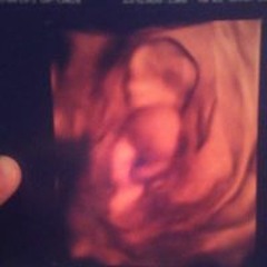 JoshandCallie Milligan