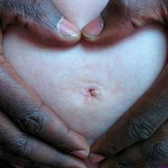 Marie-Aude Chabi-Dodane