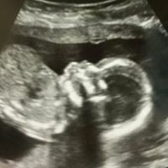 Kacie Tingle Lindsey