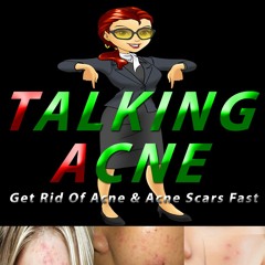 TalkingAcne