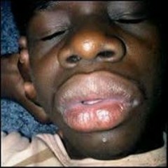 Mark Jefferson Sario