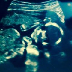 Andrew Uchiha Gentry