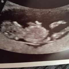 Aaron Decka Shandley