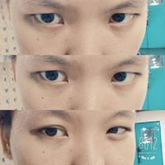 Patcharaporn Chaicana