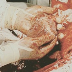 KEL KILLUMINATI REPOST