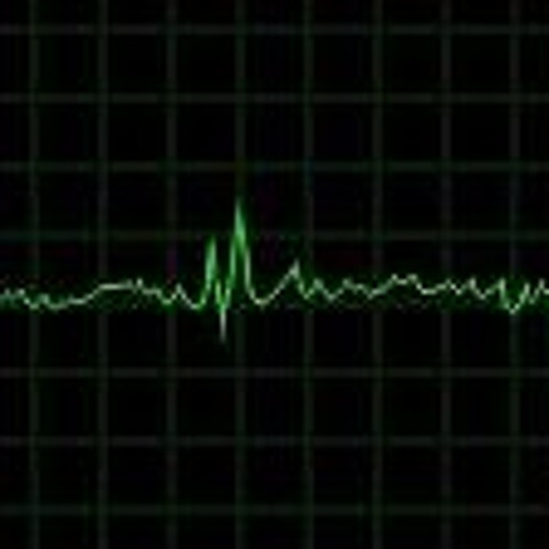 как снизить пульс. сбитый пульс. как поднять низкий пульс в домашних условиях. как снизить пульс в домашних условиях. сбитый пульс.