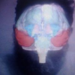 Derek Inslight Alvarado