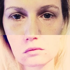 ELLI
