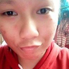 Sibug Fernandez Genel