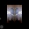 User 22312671