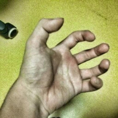 \