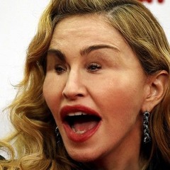 Madonnorrhea
