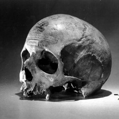 SKULL-R