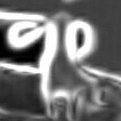 u2