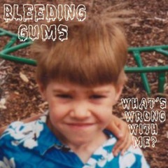 Bleeding Gums