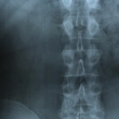 Seeing_Bones