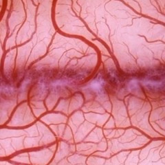 bread (retired: new project Head Hunger)