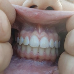 Geluidswolk
