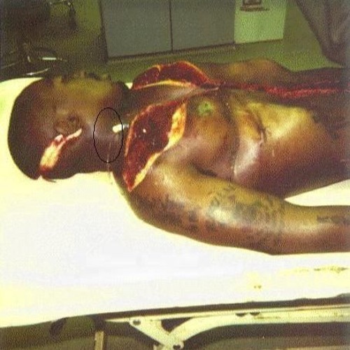 Tupac's Autopsy.