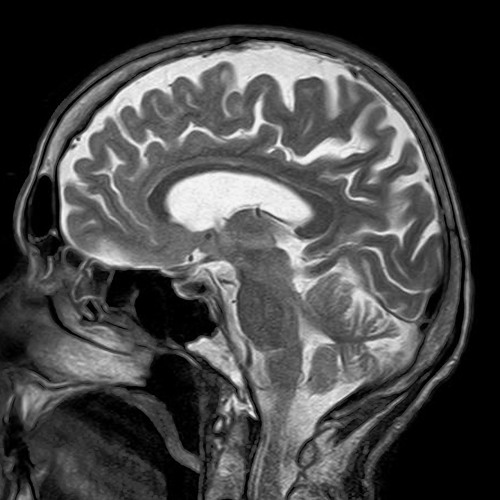 Stream Brainless music | Listen to songs, albums, playlists for free on ...