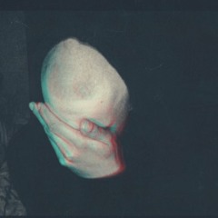 Hyperthermia