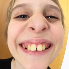 Yellow teeth kid