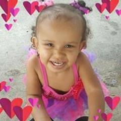 xay