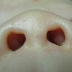 BabyNostrils