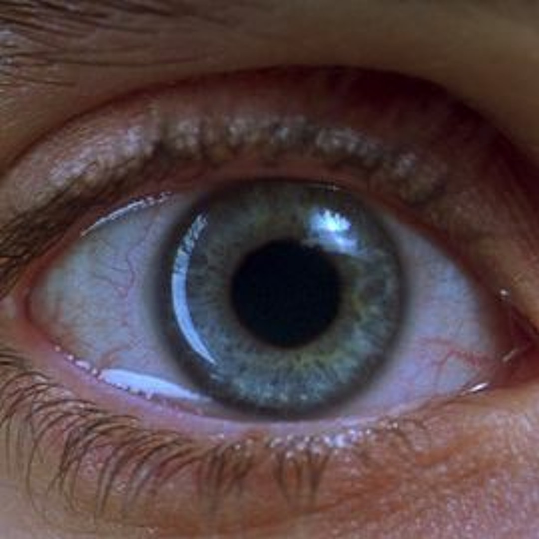 Гэрри голдфарб реквием по мечте. Паралитический мидриаз. Глаз кошки фото крупным планом макросъемка. Суживает зрачок. У одного глаза зрачок больше другого.