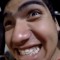 Cupeal