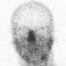 Deadnose