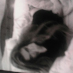 chloe👌 scars on my body cuts on my legs.