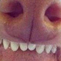 Litzbou