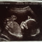 Kasey elouise Simpson