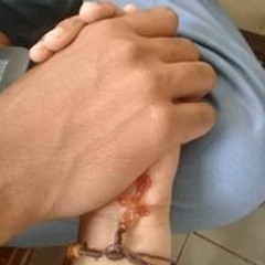 aldhy