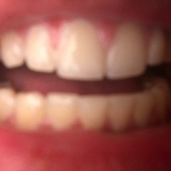 Teeth Out Rapper