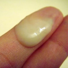 Sticky Sap