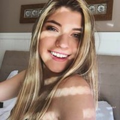Luiza Scalzo
