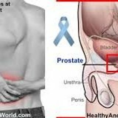 Prostatext
