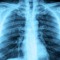 Black Lung