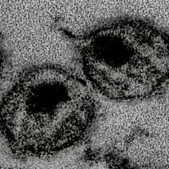 hiv grindcore
