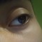 nalyd