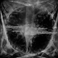 Rivets For Breakfast