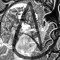 Arth